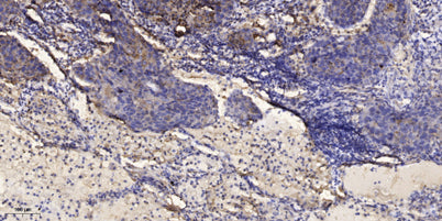 IRS-1 (phospho-Ser302)  rabbit pAb