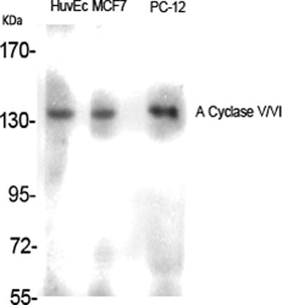 A Cyclase V/VI rabbit pAb