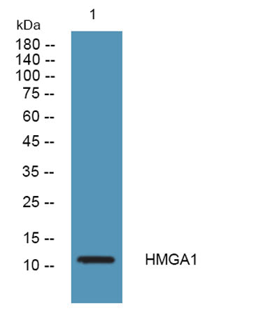 HMG-I/HMG-Y  Rabbit pAb