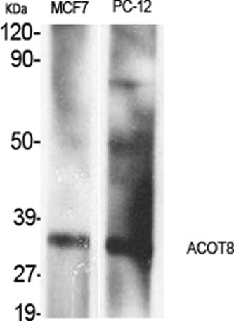 ACOT8 rabbit pAb