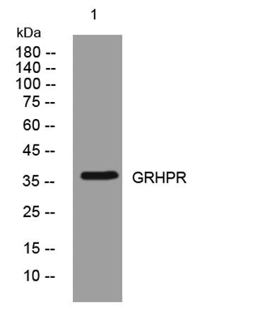 GRHPR rabbit pAb