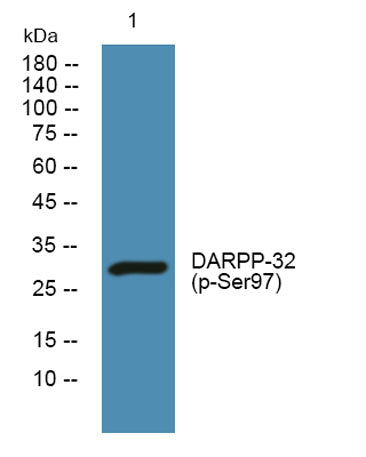 DARPP-32 (phospho-Ser97)  rabbit pAb