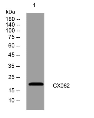 CX062 rabbit pAb