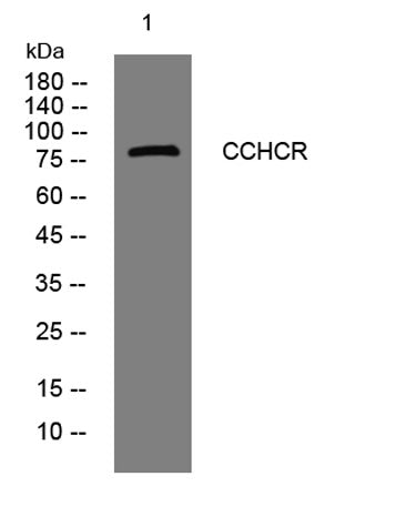 CCHCR rabbit pAb