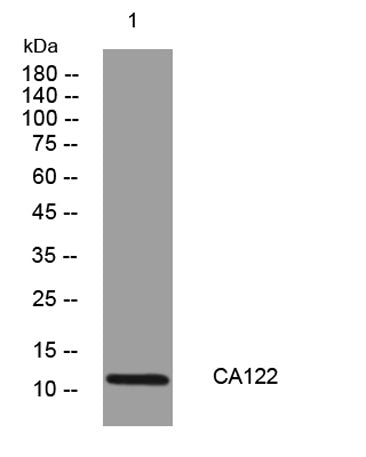 CA122 rabbit pAb
