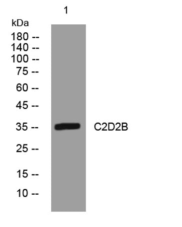 C2D2B rabbit pAb