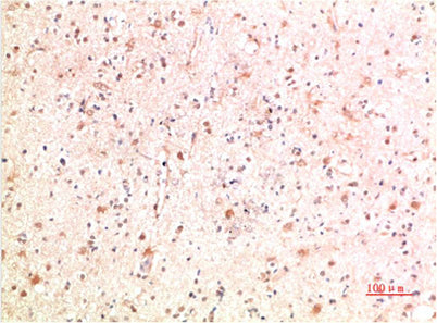PI3 Kinase P85 Rabbit rabbit pAb