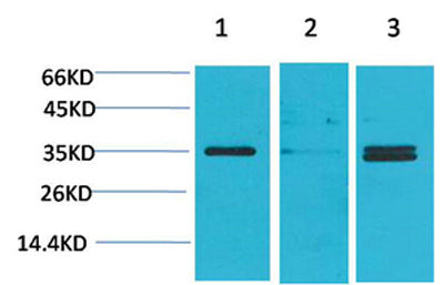 L-type Ca++ CP γ5 rabbit pAb