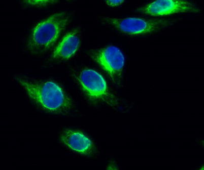 PKD1 rabbit pAb