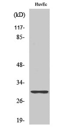 Ribosomal Protein S4Y1 rabbit pAb