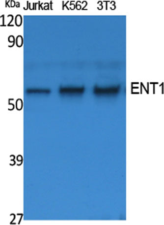 ENT1 rabbit pAb