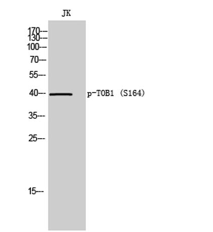 TOB1 (phospho Ser164) rabbit pAb