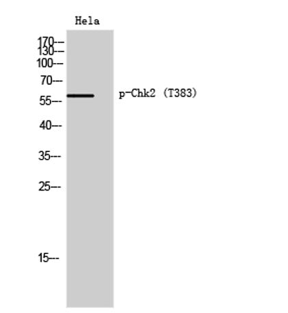 Chk2 (phospho Thr383) rabbit pAb