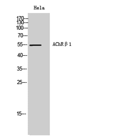 AChRβ1 rabbit pAb