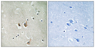 Cks2 rabbit pAb