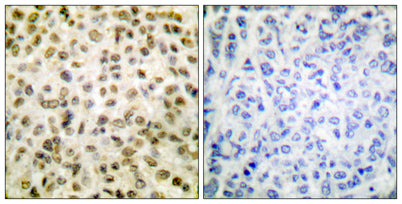 Acetyl Histone H1 (K25) rabbit pAb