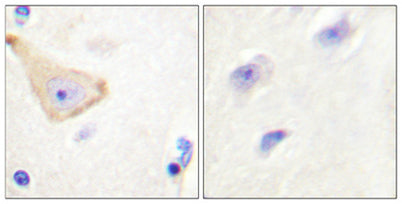 IL-3Rβ (phospho Tyr593) rabbit pAb