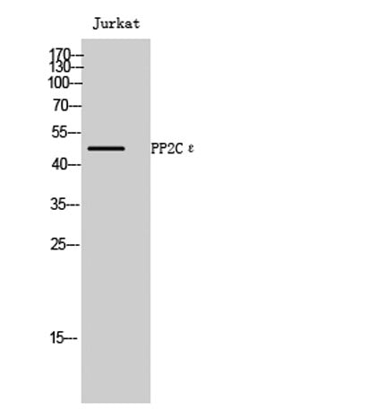 PP2Cε rabbit pAb