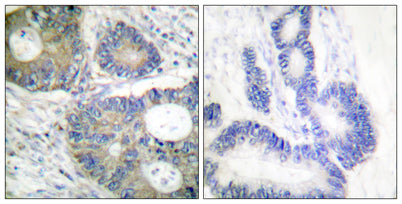 4E-BP1 rabbit pAb