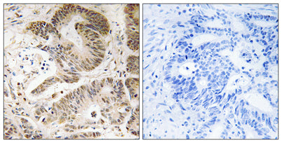 PI 3-kinase p101 rabbit pAb