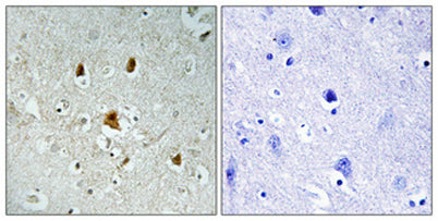 Abl1 (phospho Tyr204) rabbit pAb