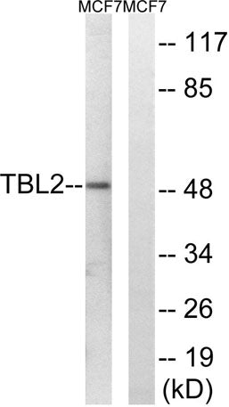 TBL2 rabbit pAb