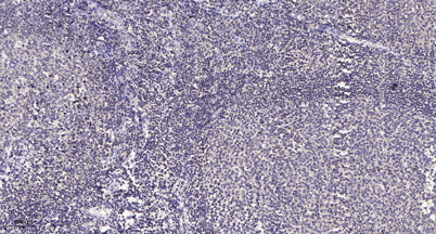 ACAD-9 rabbit pAb