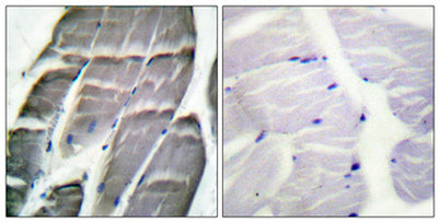 Glycogen Synthase 1 rabbit pAb