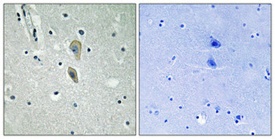 IL-1RI (phospho Tyr496) rabbit pAb