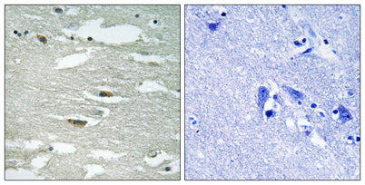 ILK (phospho Ser246) rabbit pAb
