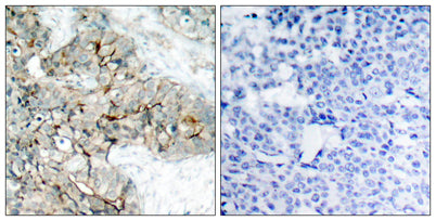 Integrin β3 (phospho Tyr773) rabbit pAb