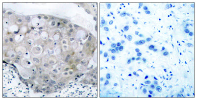 Flk-1/VEGFR2 (phospho Tyr951) rabbit pAb