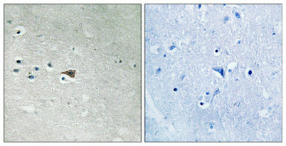Arrestin-β-1 (phospho Ser412) rabbit pAb