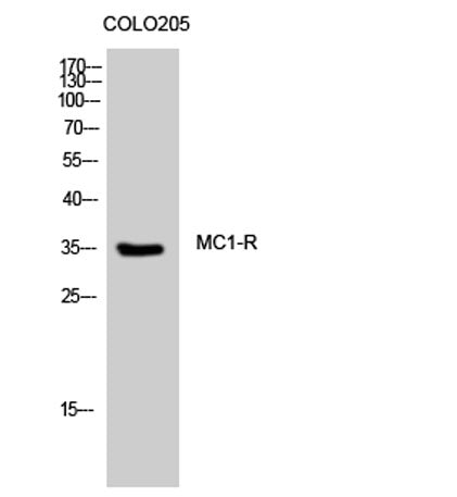 MC1-R rabbit pAb