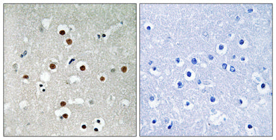 MEF-2C (phospho Ser396) rabbit pAb