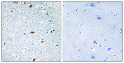 ATBF1 rabbit pAb