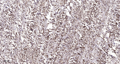 NACA (phospho Ser43) rabbit pAb