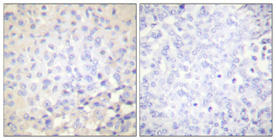 IκB-ε (phospho Ser22) rabbit pAb