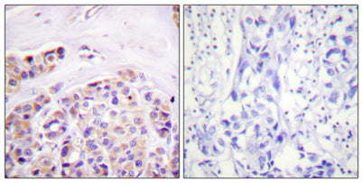IκB-ε rabbit pAb