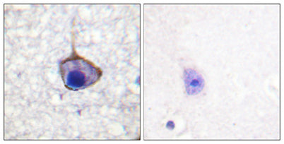 Trk A (phospho Tyr791) rabbit pAb
