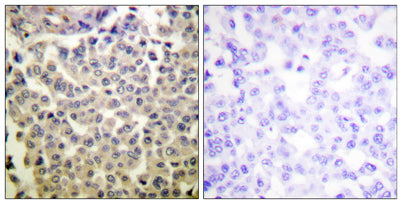 PAKα/β/γ (phospho Thr423/402/421) rabbit pAb