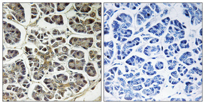 ATP5G2 rabbit pAb
