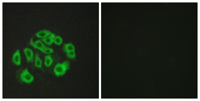 Endomucin rabbit pAb