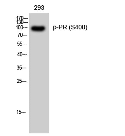 PR (phospho Ser400) rabbit pAb