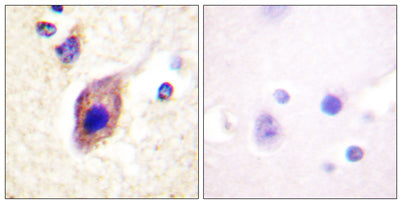 PLC γ2 rabbit pAb