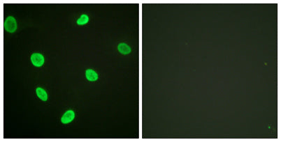 Acetyl Histone H2B (K12) rabbit pAb