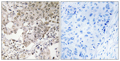 hCAP-G2 rabbit pAb