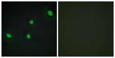 CdcA4 rabbit pAb