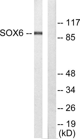 Sox-6 rabbit pAb