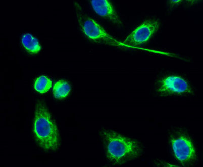 PKAα/β/γ cat (phospho Thr197) rabbit pAb